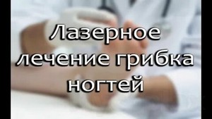 Лечение грибка ногтя дифлюкан