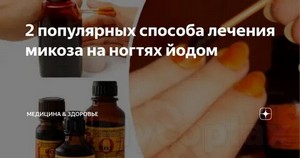 Народные средства лечения грибка ногтей уксус