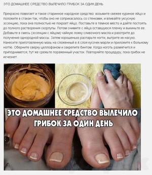 Рецепт лечения грибка ногтей на ногах уксусом