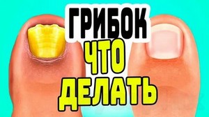 Лучший препарат для лечения грибка ногтей