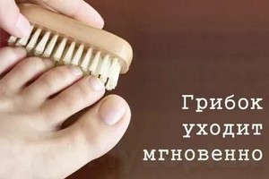 Грибок ногтей лечение тамбов