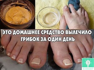 Лечение грибка ушей у собак