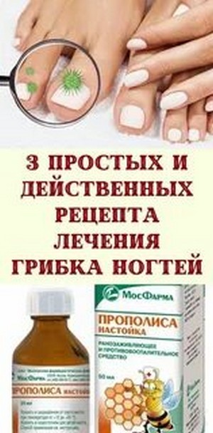 Соль лечение грибка ногтей