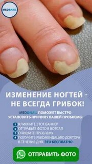 Новые препараты для лечения грибка ногтя