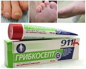 Стоимость лазерного лечения грибка ногтей