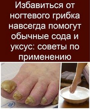 Лечение грибка ногтей лаком отзывы