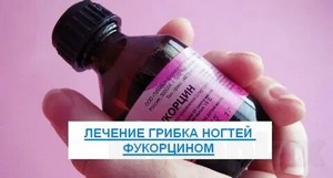 Паховая область грибок лечение