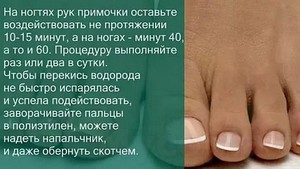 Лечение грибка уксусом и перекисью водорода