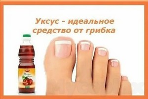 Народные методы лечения грибка кожи ног