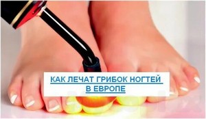 Лечение ногтей от грибка самое эффективное отзывы