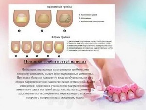 Грибок половых органов лечение мазь