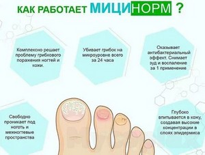 Препараты для лечения грибка ногтей на ногах и отзывы