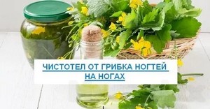 Грибки ногтей народными средствами лечение