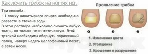 Эффективные способы лечения грибка на ногах