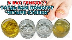 Лечение грибка на ногтях ног перекисью