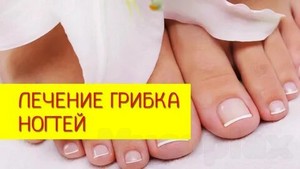 Ванночки для лечения грибка ногтей рук