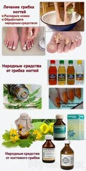 Грибок ногтей на ногах лечение серной мазью