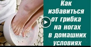 Народные способы лечения грибка ногтя на ноге