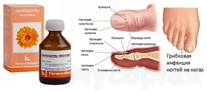 Масло черного тмина лечение грибка ногтей