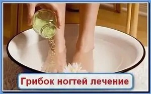 Лак для лечения грибка ногтей какой лучше