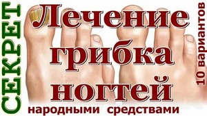 Лечение грибка ногтей на ногах новосибирск